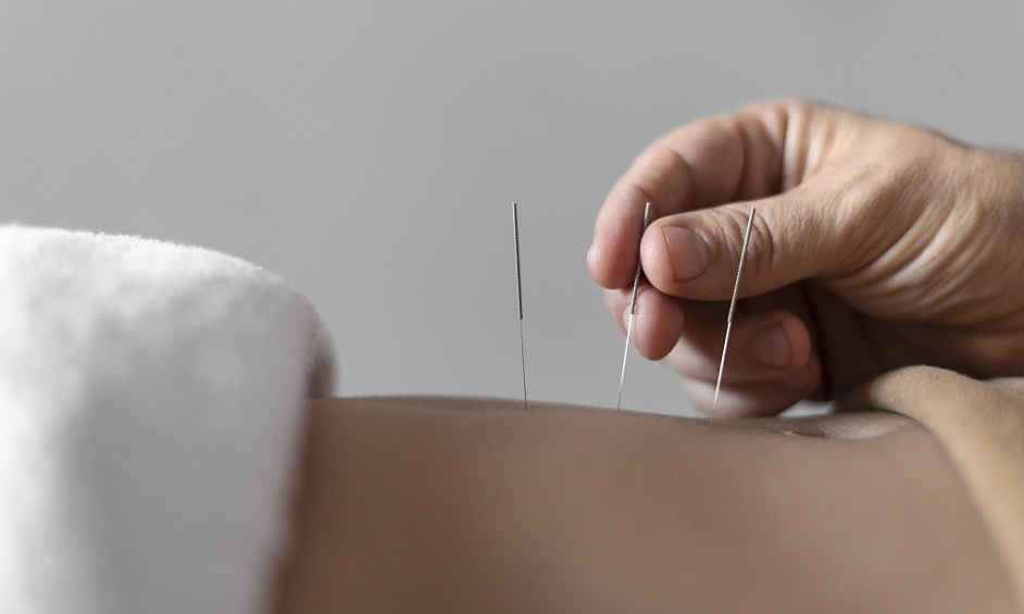 Clinique d'Acupuncture et de Santé À Vendre Orewa, Auckland 1
